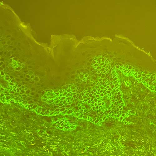 Inmunohistoquímica. Anatomía patológica. LoMás, Dermatología y Medicina Estética Integral. Recoletas Salud